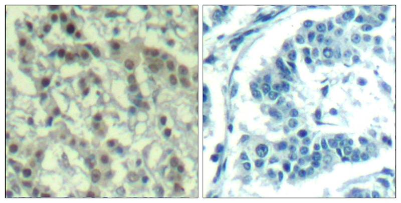 Aurora A (phospho-Thr288) Antibody