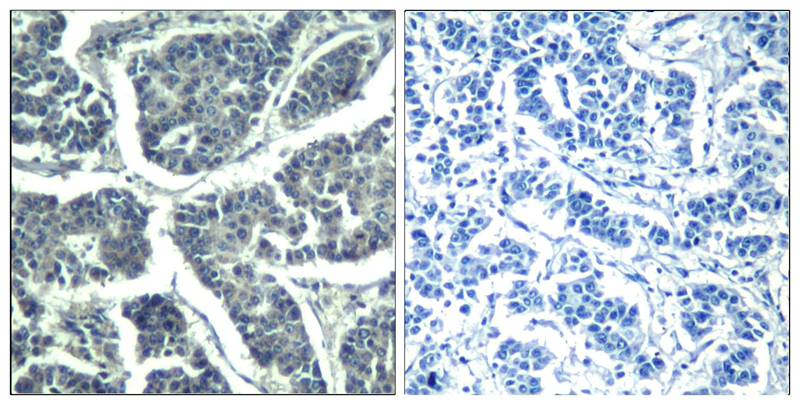 PLC-γ2 (phospho-Tyr1217) Antibody