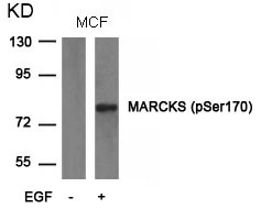 MARCKS (phospho-Ser170) Antibody