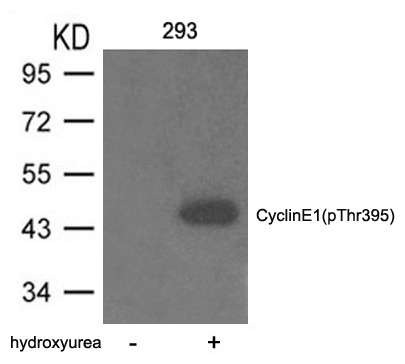 Cyclin E1 (phospho-Thr395) Antibody