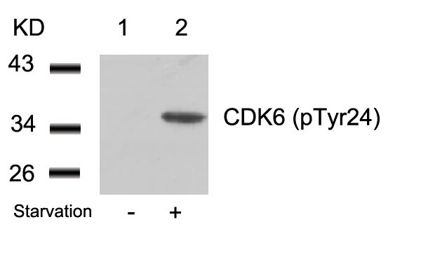 CDK6 (phospho-Tyr24) Antibody
