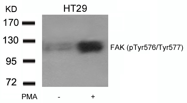 FAK (phospho-Tyr576/Tyr577) Antibody