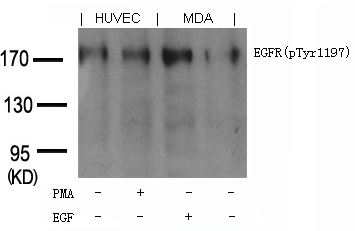 EGFR (phospho-Tyr1197) Goat Polyclonal Antibody