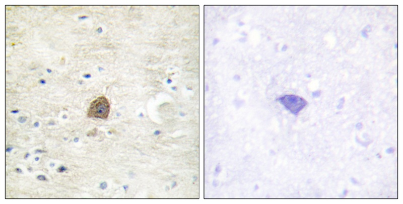 CaMK2α/β/δ (Phospho-Thr305) Antibody