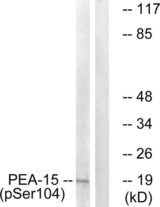 PEA5 (Phospho-Ser104) Antibody
