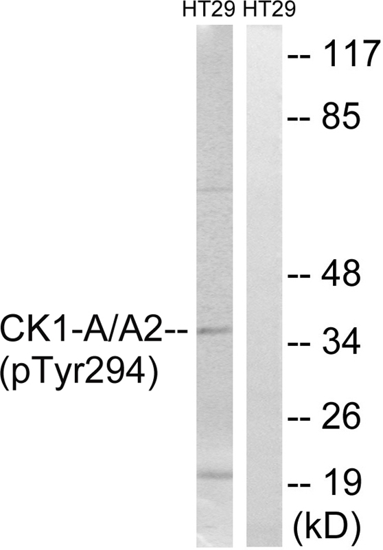 CKα (Phospho-Tyr294) Antibody