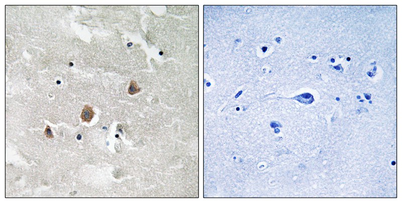 MAP3K1 (Phospho-Thr1400) Antibody
