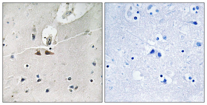 Ephrin B1/B2/B3 (phospho Y324/Y311/Y318)