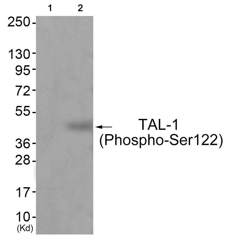 TAL (Phospho-Ser122) Antibody