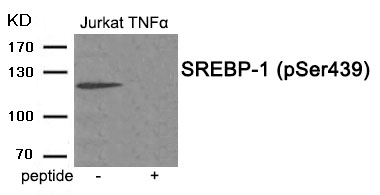 SREBP (Phospho-Ser439) Antibody