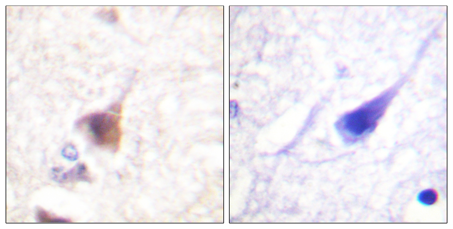 CaMK4 (Phospho-Thr200) Antibody