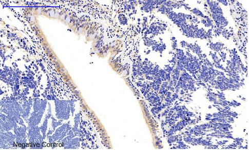 CaMK2- beta/ gamma/ delta (Phospho-Thr287) Antibody