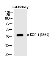 KOR (Phospho-Ser369) Polyclonal Antibody