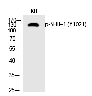 SHIP (Phospho-Tyr1021) Polyclonal Antibody