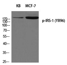 IRS (Phospho-Tyr896) Polyclonal Antibody