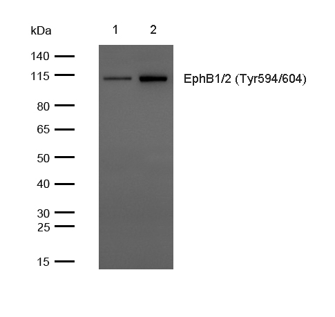 EphB1/2 (Phospho-Tyr594/604) Polyclonal Antibody