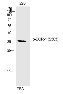 DOR (Phospho-Ser363) Polyclonal Antibody