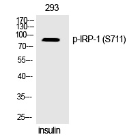 IRP (Phospho-Ser711) Polyclonal Antibody