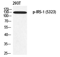 IRS (Phospho-Ser323) Polyclonal Antibody