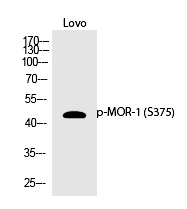 MOR (Phospho-Ser375) Polyclonal Antibody