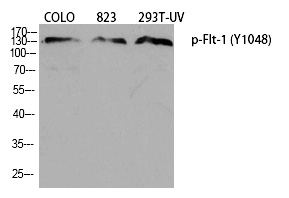 Flt (Phospho-Tyr1048) Polyclonal Antibody