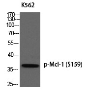 Mcl (Phospho-Ser159) Polyclonal Antibody