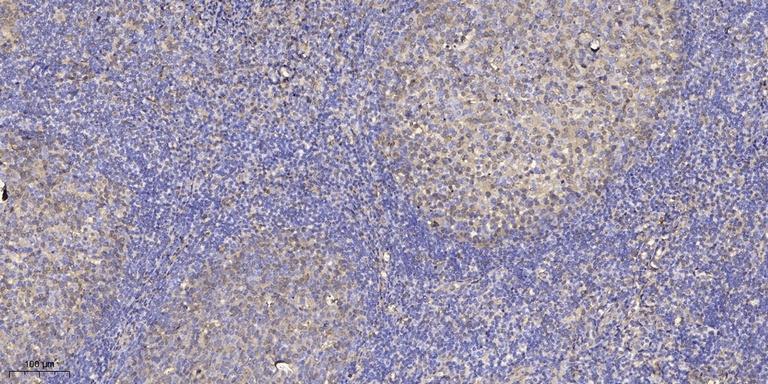 SHC (Phospho-Ser36) Antibody