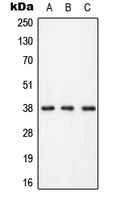 LAT (Phospho-Tyr255) Antibody
