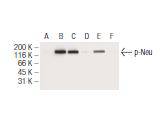 HER2 / ErbB2 (Phospho-Thr 686) Antibody
