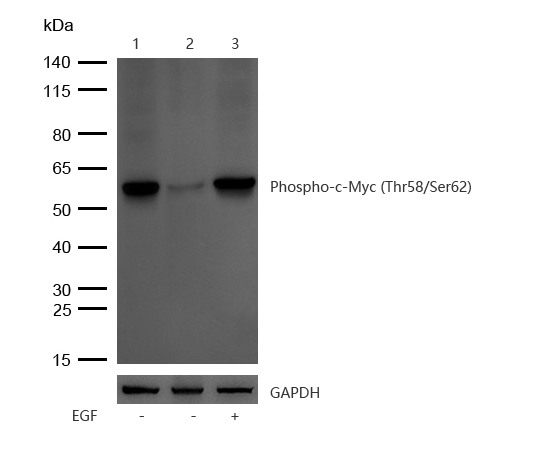 c-Myc (Phospho-T58/S62) Rabbit mAb