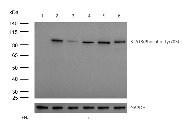 STAT3(Phospho-Tyr705) Rabbit mAb