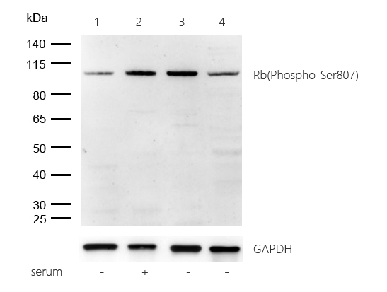 Rb(Phospho-Ser807) Rabbit mAb