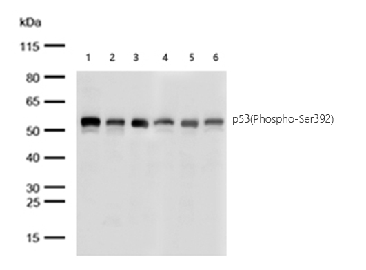 p53(Phospho-Ser392) Rabbit mAb