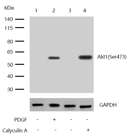 Akt1(Phospho-Ser473) Rabbit mAb