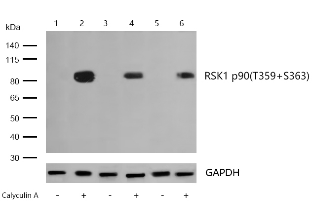 RSK1 p90(Phospho-T359/S363) Rabbit mAb