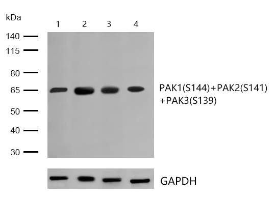 PAK1/PAK2/PAK3(Phospho-S144/S141/S139) Rabbit mAb
