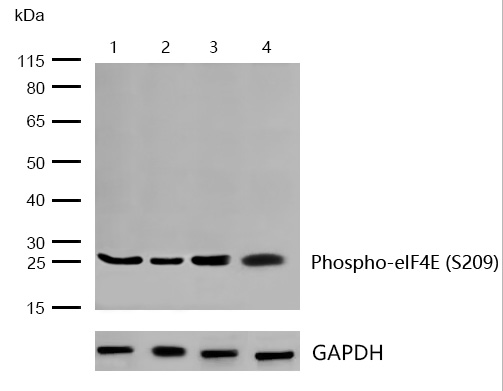 eIF4E (Phospho-S209) Rabbit mAb