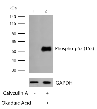 p53 (Phospho-T55) Rabbit mAb