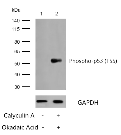 p53 (Phospho-S376) Rabbit mAb