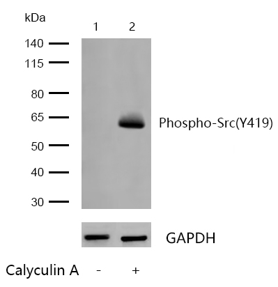 Src(Phospho-Y419) Rabbit mAb