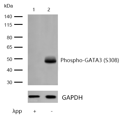 GATA3 (Phospho-S308) Rabbit mAb