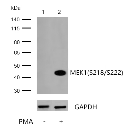 MEK1(Phospho-S218/S222) Rabbit mAb