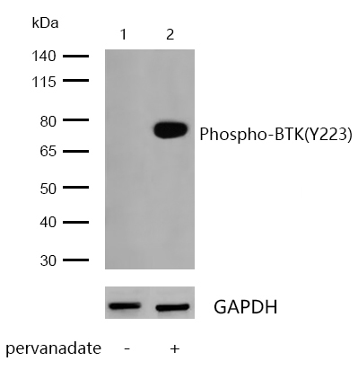 BTK(Phospho-Y223) Rabbit mAb