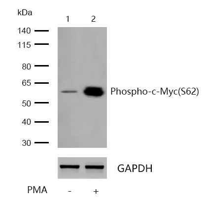 c-Myc(Phospho-S62) Rabbit mAb