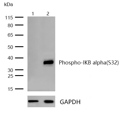 IKB alpha(Phospho-S32) Rabbit mAb