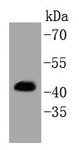 Erk1(Phospho-pT202/pY204)+Erk2(Phospho-pT185/pY187) Antibody