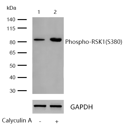 RSK1(Phospho-S380) Rabbit mAb