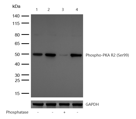 PKA R2 (Phospho-S99) Rabbit mAb