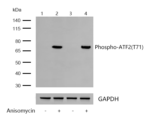 ATF2(Phospho-T71) Rabbit mAb