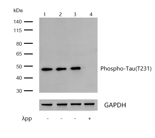 Tau(Phospho-T231) Rabbit mAb